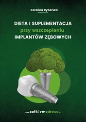 : Dieta i suplementacja przy wszczepieniu implantów zębowych - ebook