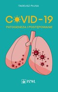 COVID-19 Patogeneza i postępowanie - ebook